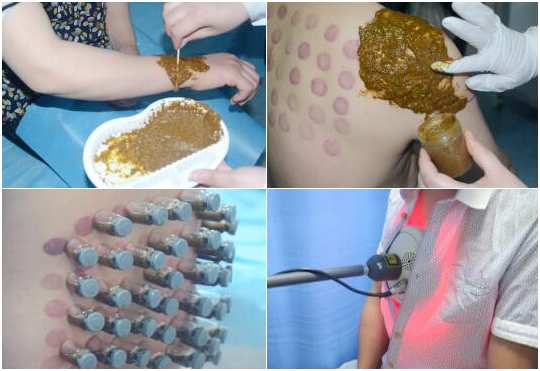 MK体育·(国际)官方网站：向中医药看齐，与世界共享中医药文化(图4)