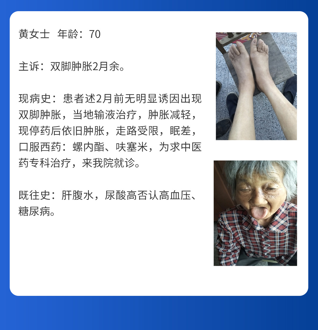 【北京市中西医结合MK体育·(国际)官方网站】第三期会诊(图7)